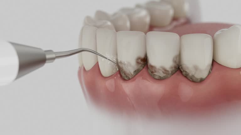 Reliable Dental Implants contractor in Penngrove, CA by Smile Center Dentistry
